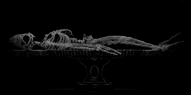 Bone histology: Protean