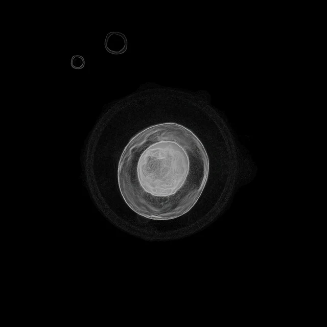 Protoplasm